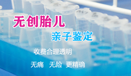 盐城怀孕如何做DNA亲子鉴定最简单方便,盐城孕期亲子鉴定如何收费 盐城怀孕如何做DNA亲子鉴定最简单方便,盐城孕期亲子鉴定如何收费
