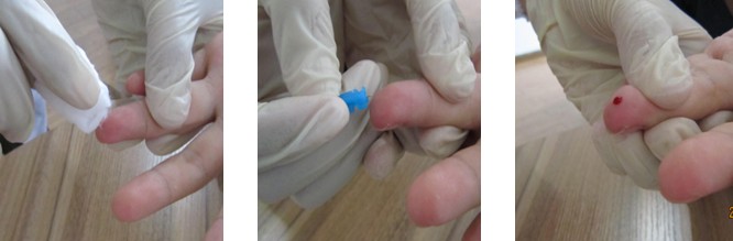 血痕样本采集操作方法 血痕样本采集操作方法